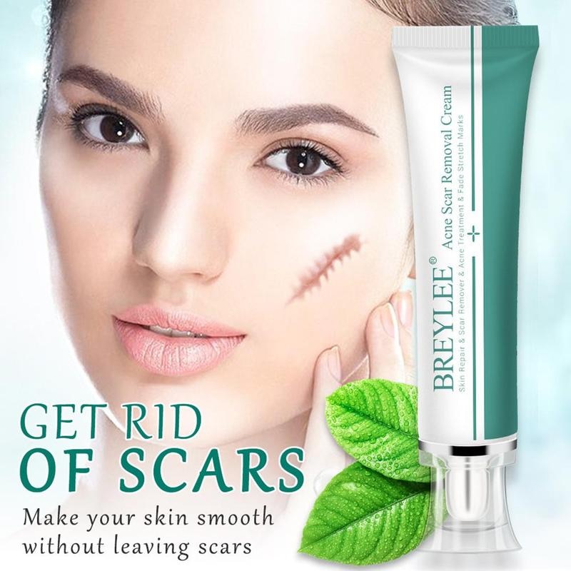 BREYLEE Acne Scar Removal Cream Face Cream Skin Repair ...