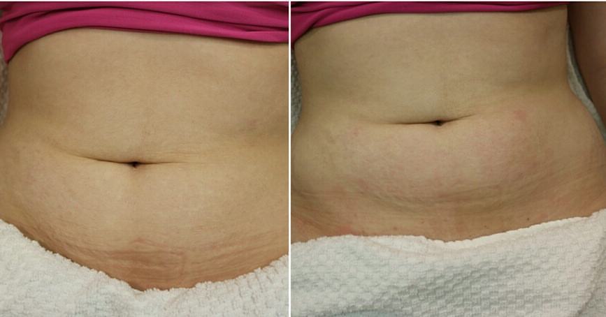 Gallery | KDG Laser Treatment Centre