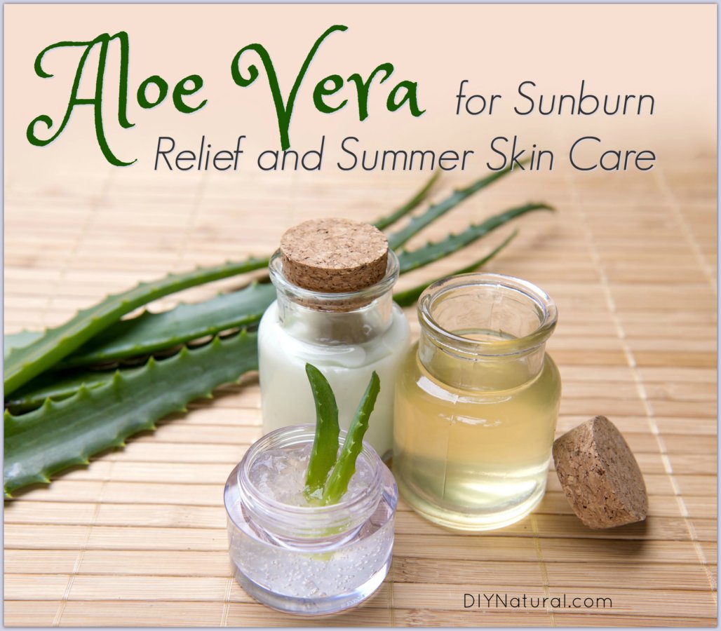Home Remedies for Sunburn: Using Aloe Vera for Summer Skin ...