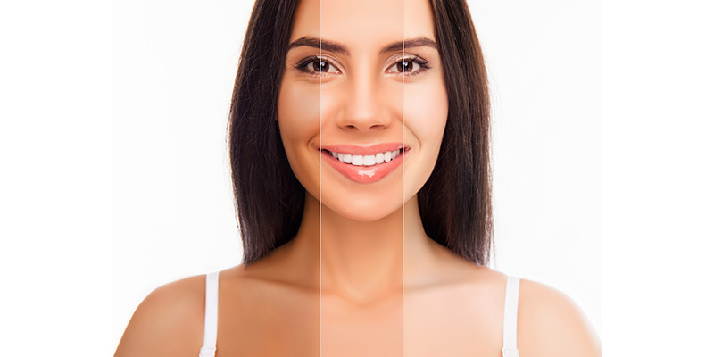 Skin Whitening Injections Pakistan Price | Islamabad ...